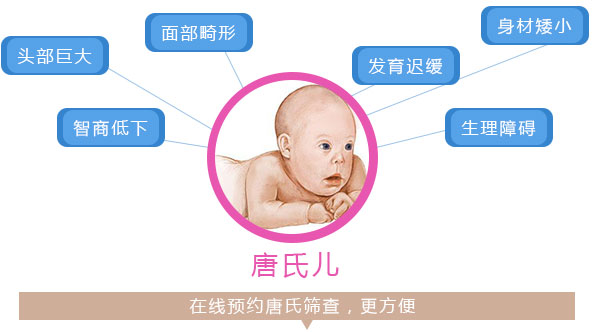 唐氏筛查